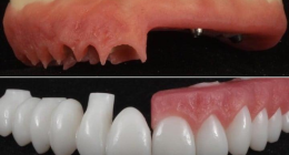 dentista utilizando tecnologia digital para planejamento de implante dentário em consultório moderno