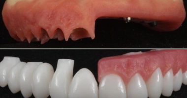 dentista utilizando tecnologia digital para planejamento de implante dentário em consultório moderno