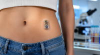 Protótipo de mini-pâncreas biológico aparece aplicado na região abdominal durante demonstração da tecnologia em desenvolvimento.