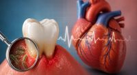 Ilustração mostra um dente em primeiro plano e um coração humano ao fundo, representando a relação entre saúde bucal e doenças cardiovasculares.