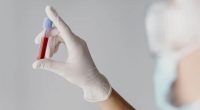 Profissional de saúde realizando coleta de sangue para exame laboratorial, ilustrando novo teste associado ao Alzheimer.